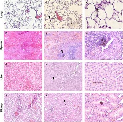 Biodistribution of intravenously delivered PEGylated carbon nanotubes to the rat brain cortex